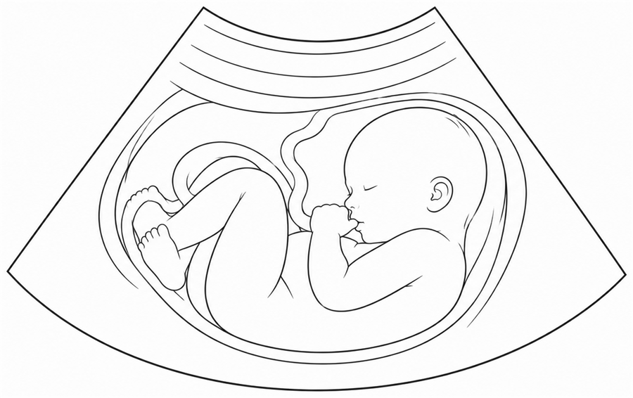 Derde trimester